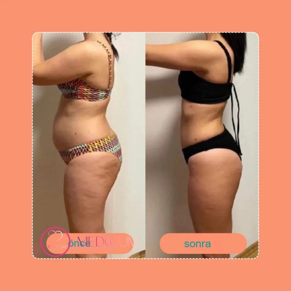 Medocum-BodyTone Pro